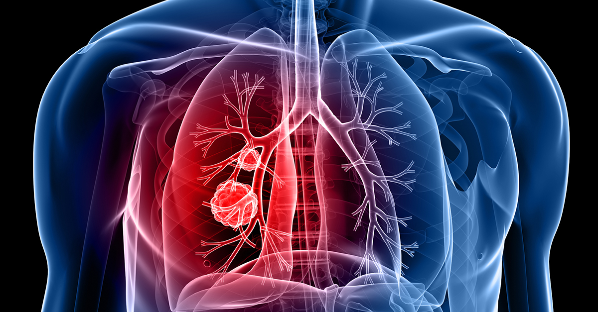 Lung