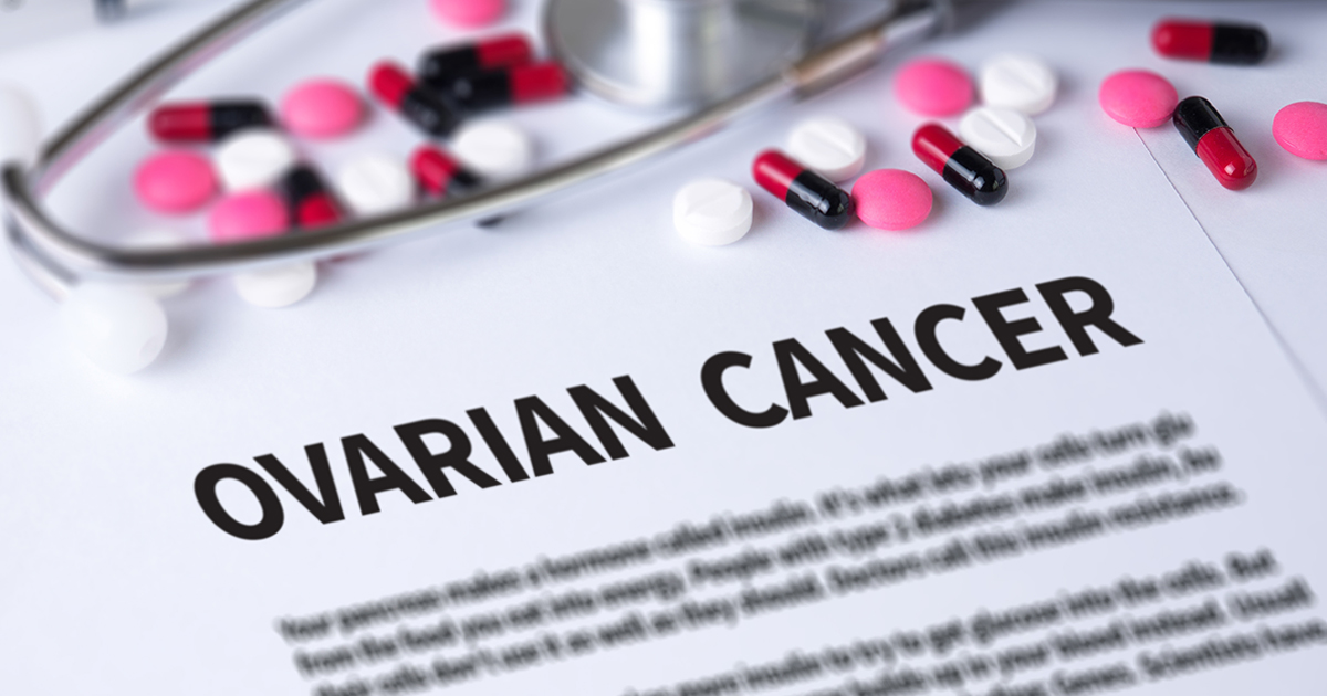 ovarian cancer