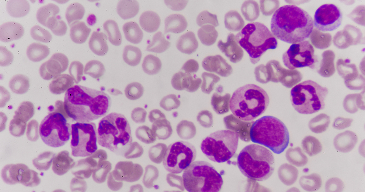 leukemia