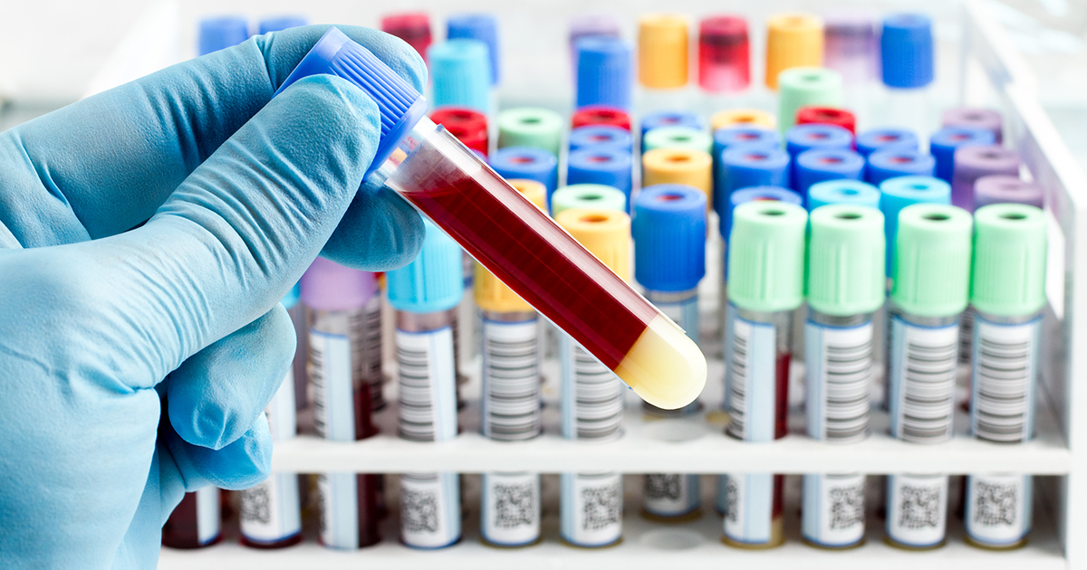 liquid biopsy