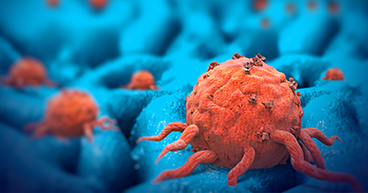 Tumor-Cell