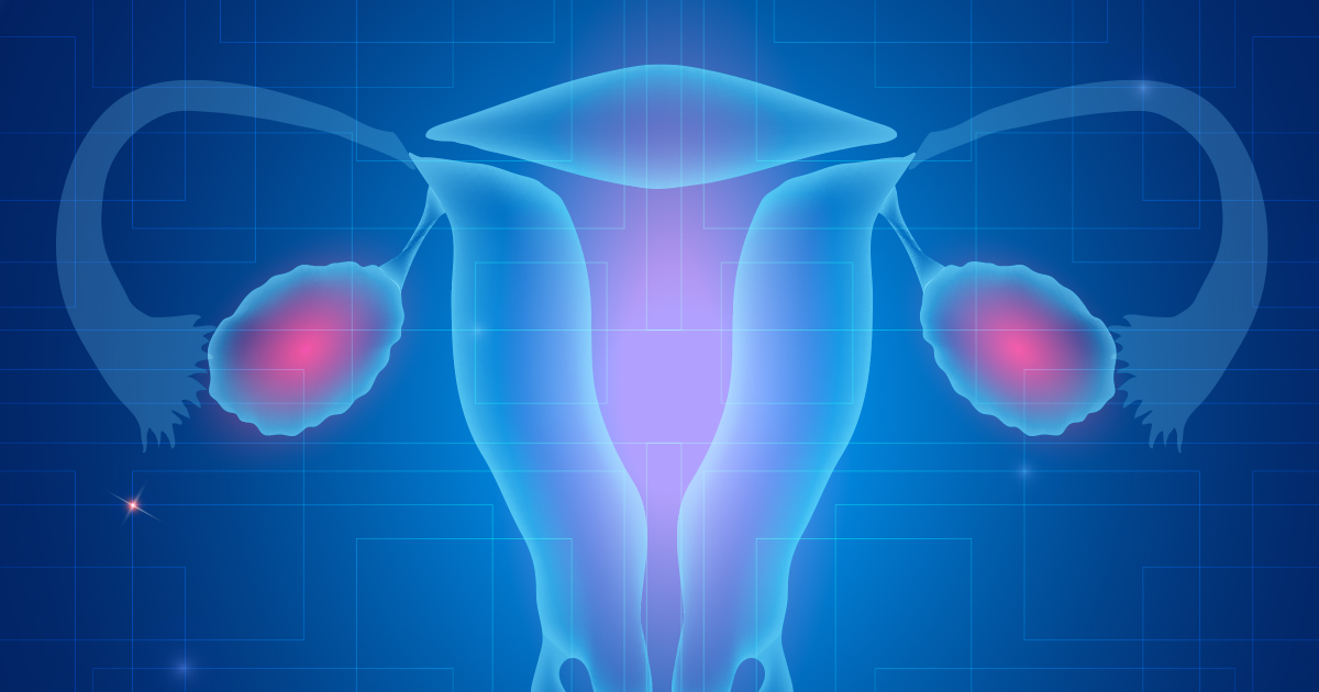 Study Fallopian tube  lesions an early sign of ovarian 