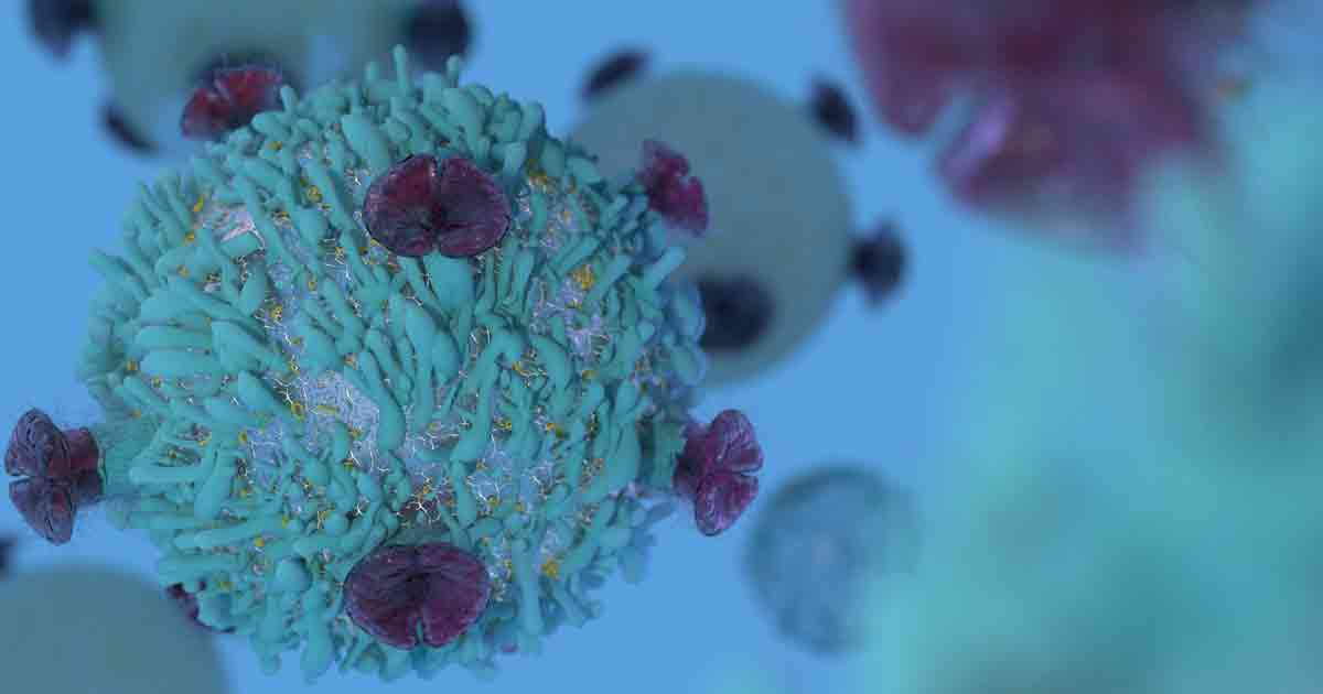 Microscopic view of metastatic breast cancer